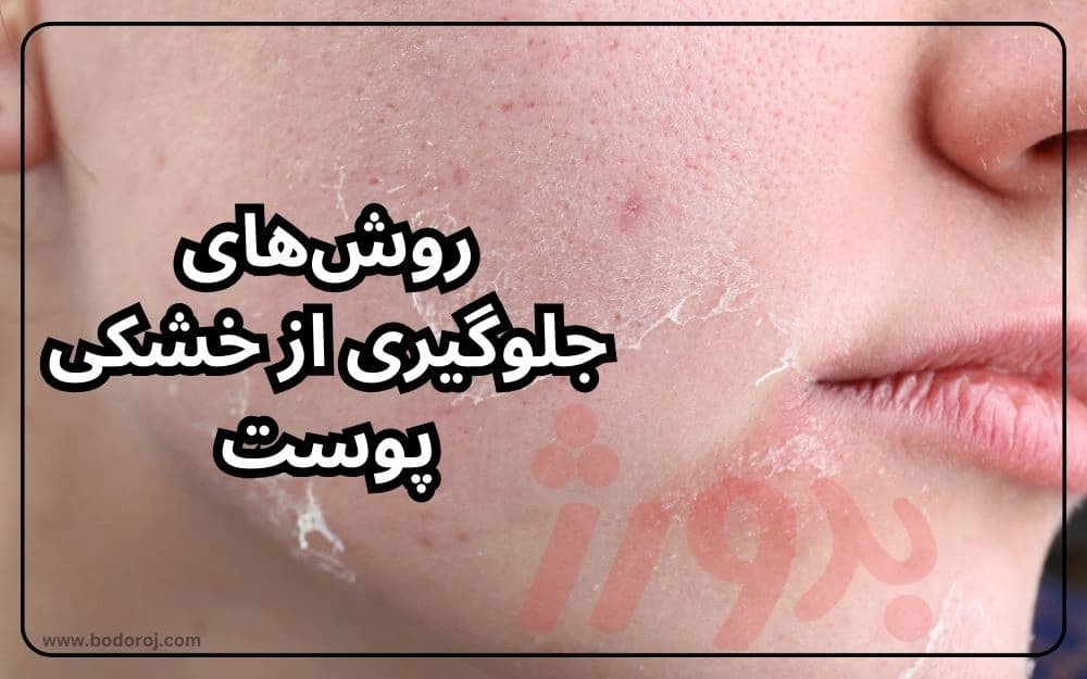 prevent-dry-winter-skin-tips