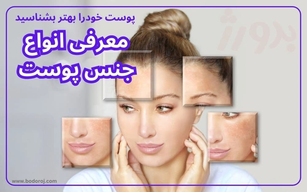 انواع-تایپ-پوستی