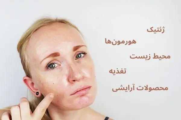 مراقبت از پوست چرب