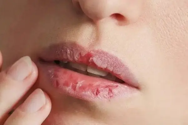 عوارض استفاده از رژ لب دارای سرب