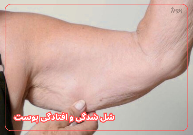 عکس مربوط به مشکلات رایج پوست بدن با کیفیت بدون بکگراند افتادگی و شل شدن عضلات