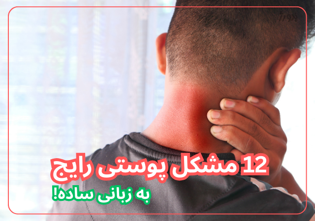 مشکلات رایج پوست بدن از گردن تا پا