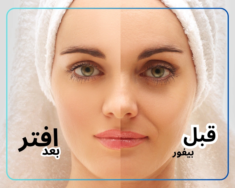 قبل و بعد استفاده از بهترین کرم ضد چروک